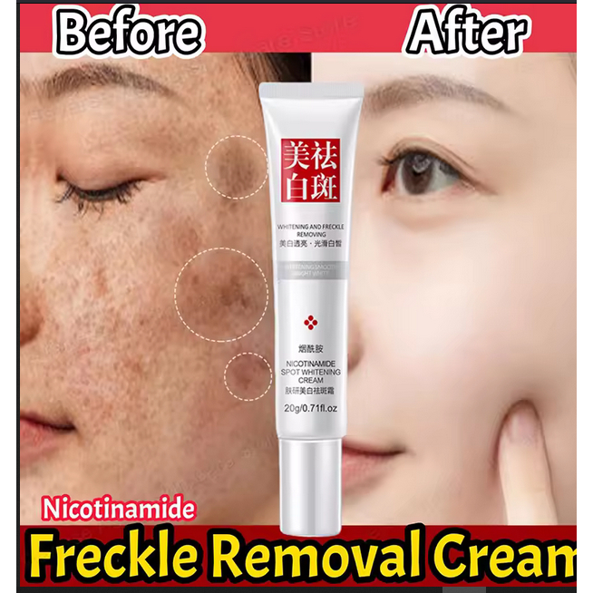 Krim Penghilang Bintik Hitam Pemutih Wajah Efektif Memperbaiki Kulit Kusam Anti-pigmentasi Menghilan