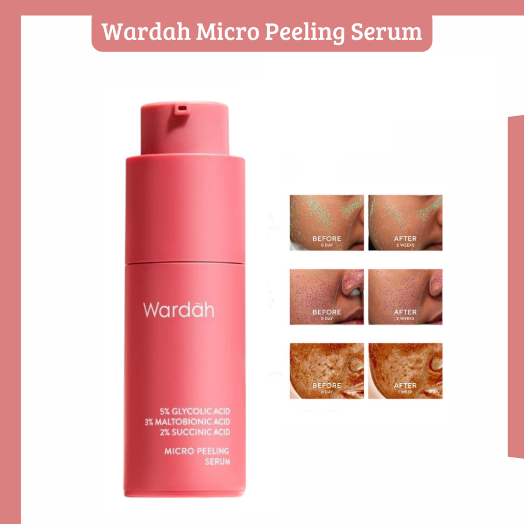 Wardah 5% Glycolic Acid Micro Peeling Serum 20ml/Serum Wajah