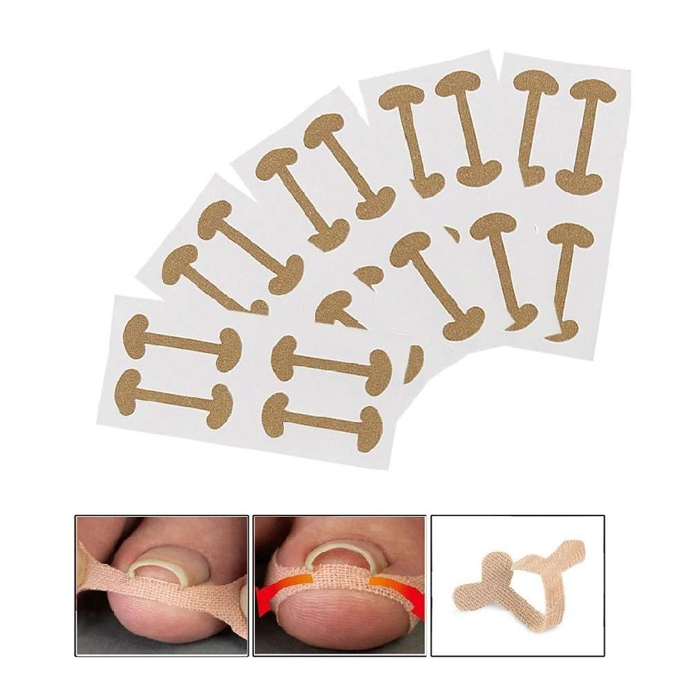 Bantalan Silikon Koreksi Perawatan Kuku Ingrown Nail Isolation Pad Cantengan Treatmen Kuku