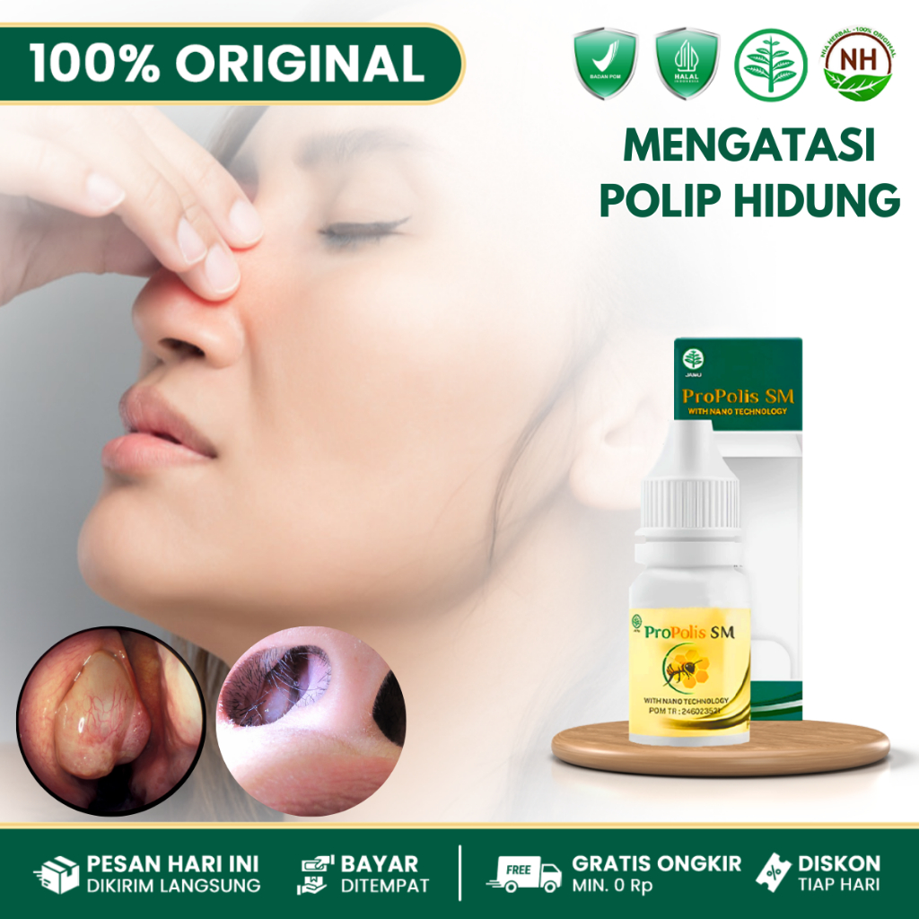 Obat Polip Hidung, Obat Hidung Tersumbat, Obat Hidung Mempet, Polip Menahun Pada Anak - Propolis 6ML