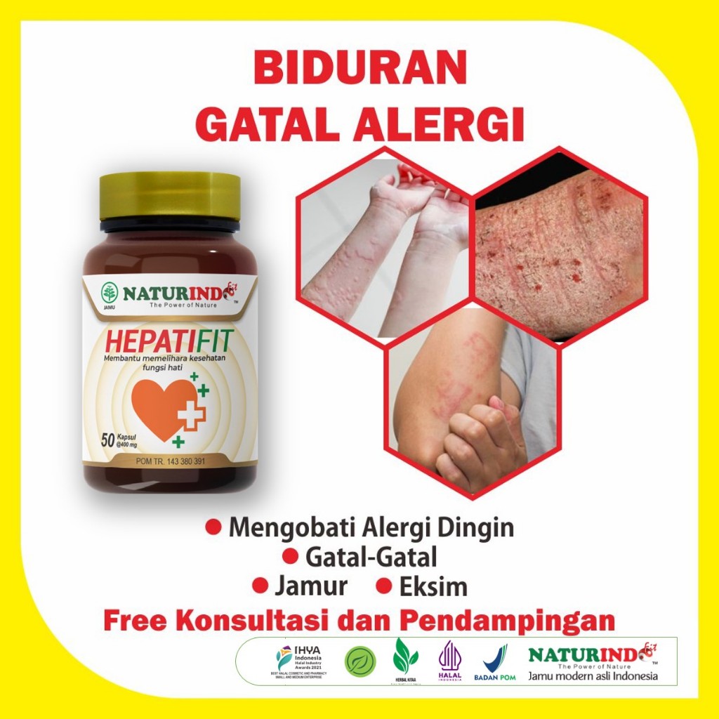 Jamu Herbal Biduran Kaligata Gatal-gatal Alergi Dingin Debu Exim Hepatifit Naturindo