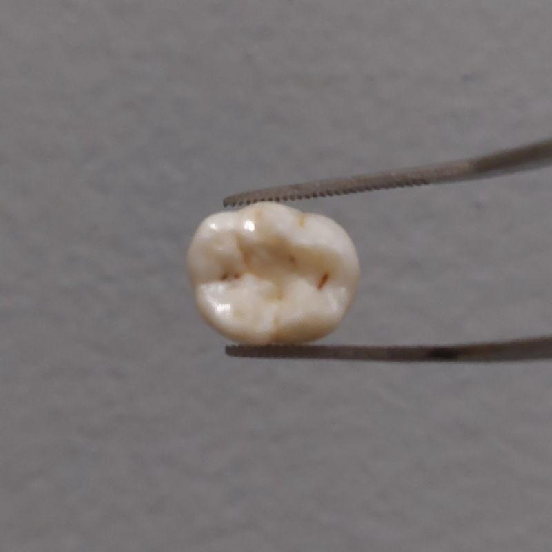 Gigi Sulung Anak Pedo Rahang Atas Bawah Asli Praktikum FKG