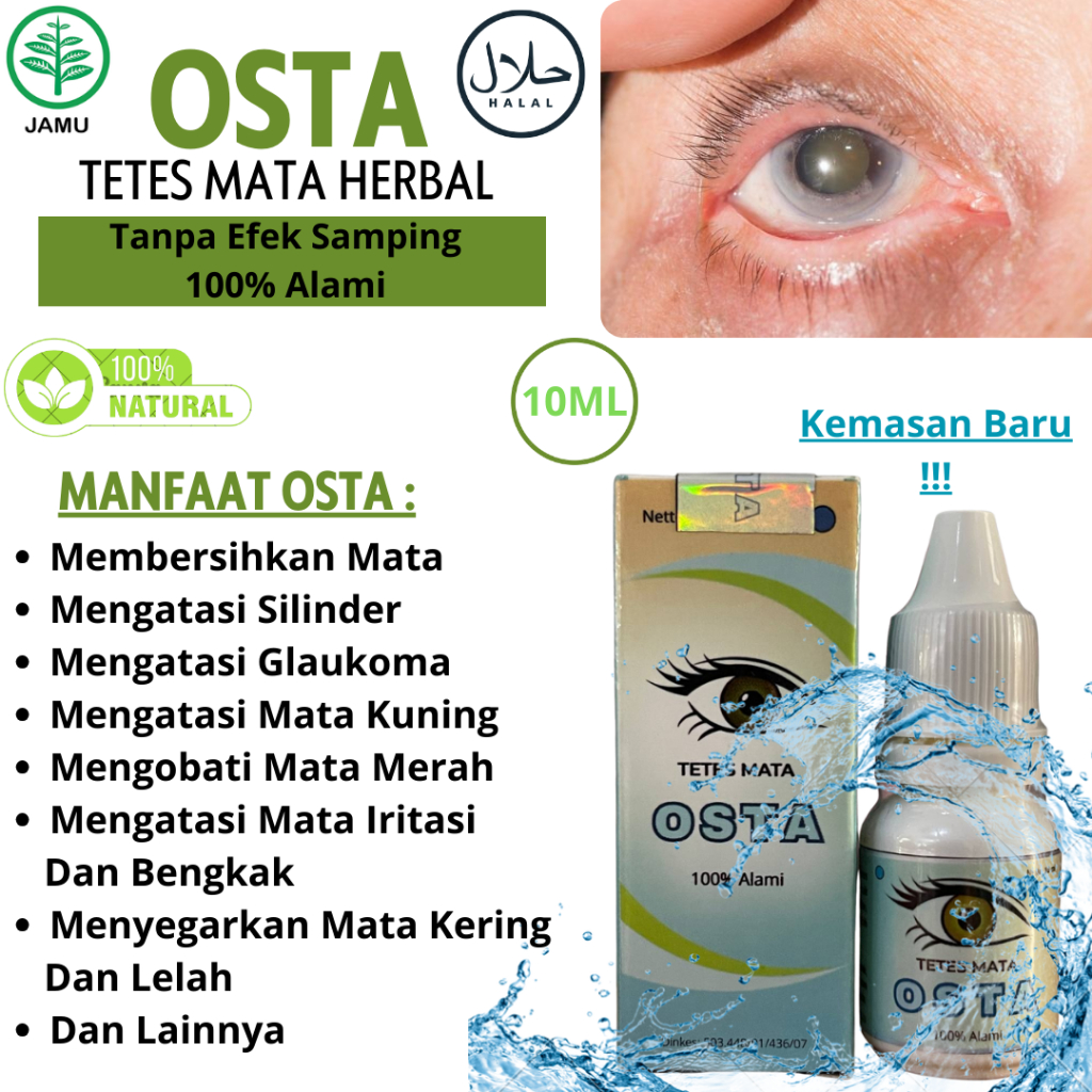 Obat tetes mata katarak, mata minus, Glaukoma SILINDER, Mata Merah, Gatal OSTA BPOM