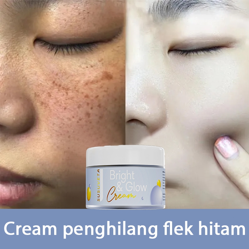 Cream penghilang flek hitam cream flek hitam membandel bpom salep flek hitam membandel 30g salep fle