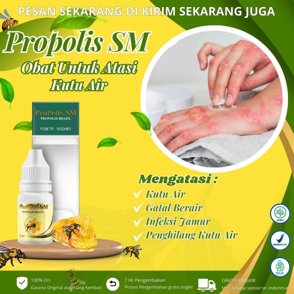 Propolis Sm - Obat Kutu Air, Penghilang Kuman Air, Obat Gatal Berair, Obat Oles Kulit Gatal