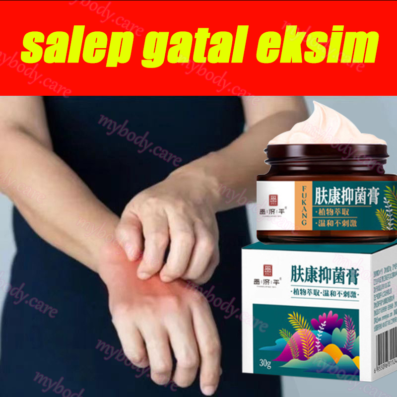 Salep gatal Obat gatal selangkangan salep gatal kulit yang ampuh 30g Salep gatal selangkangan Salep 