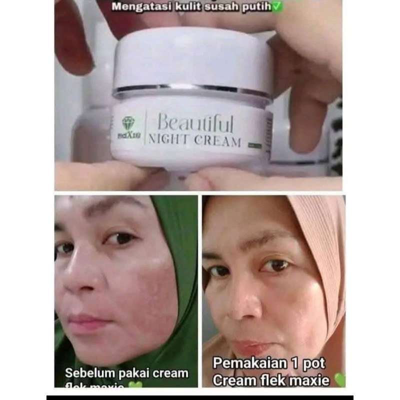 COD Cream Flek Maxie ORI / Salep Flek K.Terbaru Ampuh K. Terbaru Bpom MurahCream pemutih Glowing Sal