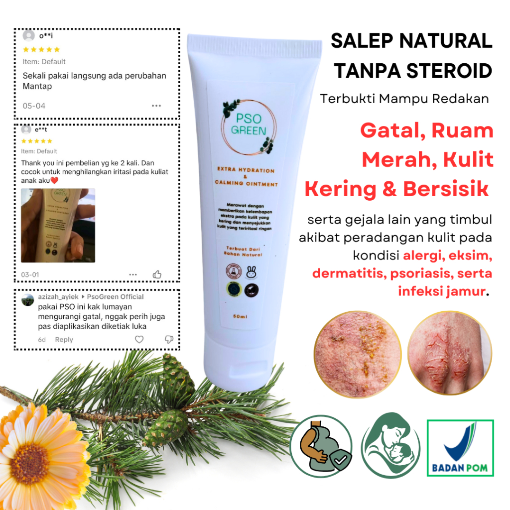 Psogreen Salep Gatal Ampuh Selangkangan,Ketiak,Eksim,Infeksi Jamur,Psoriasis,Aman Bumil Busui