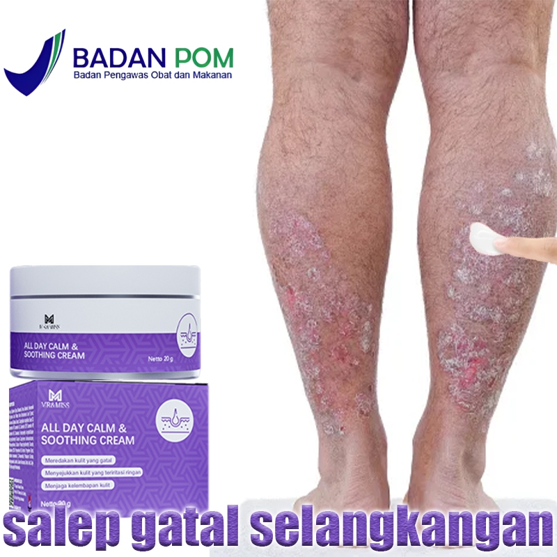 salep gatal china paling ampuh salep gatal obat gatal 0bat gatal gatal kulit 0bat gatal selangkangan