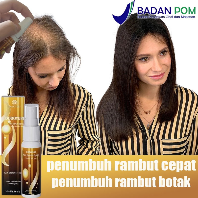 penumbuh rambut serum penumbuh rambut penumbuh rambut botak serum rambut penumbuh rambut 30ml Penumb