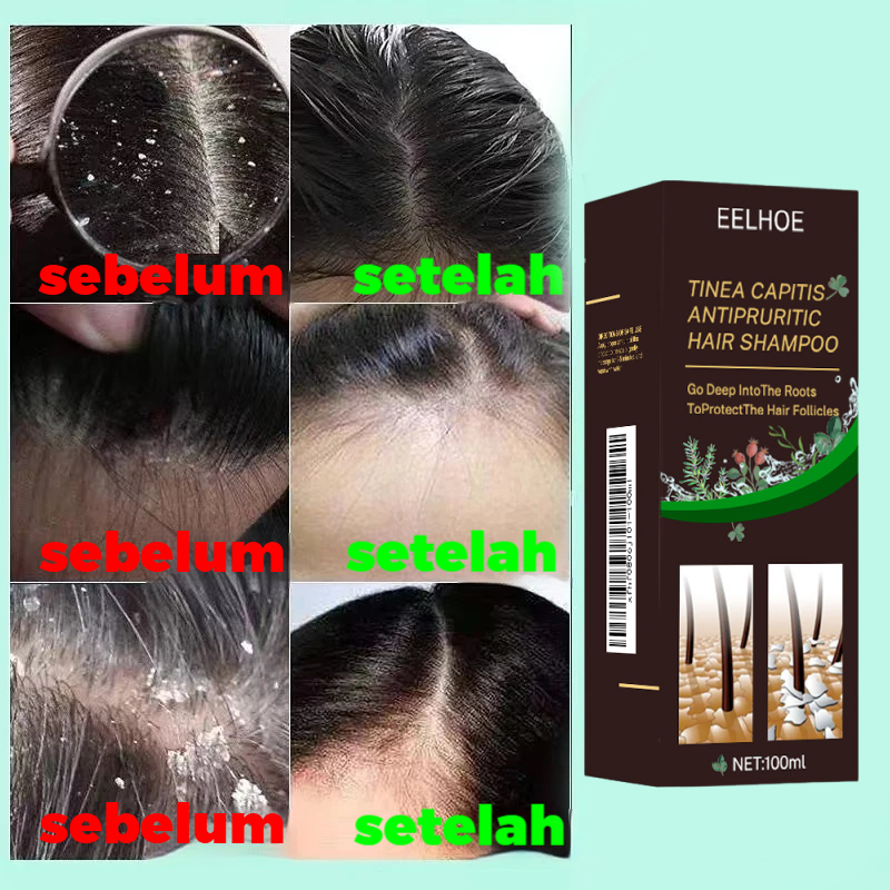 Shampo anti ketombe dan gatal, anti rambut rontok, pengontrol minyak yang menyegarkan, perawatan ram