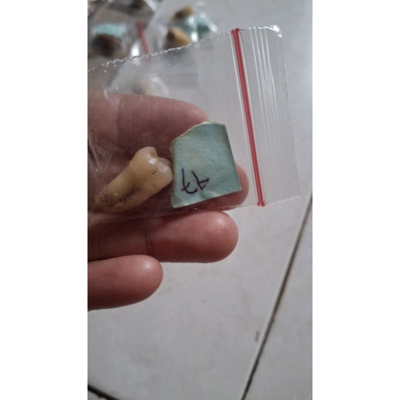 Unsur gigi praktikum Unsur 17, 26, 27, 37