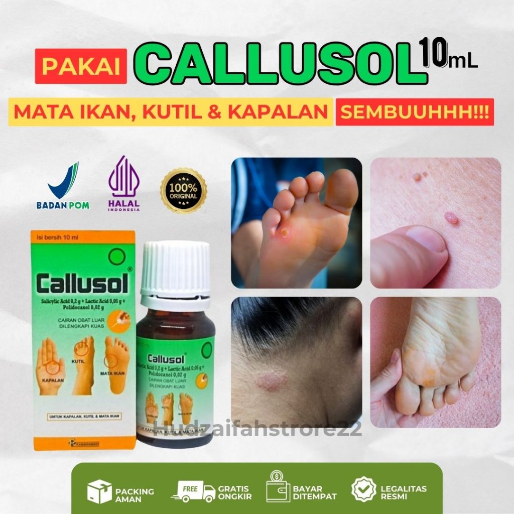 Original Callusol 10ml Cairan Obat Luar Untuk Kalus Kapalan Kutil Mata Ikan Plaster Pembasmi Penghil