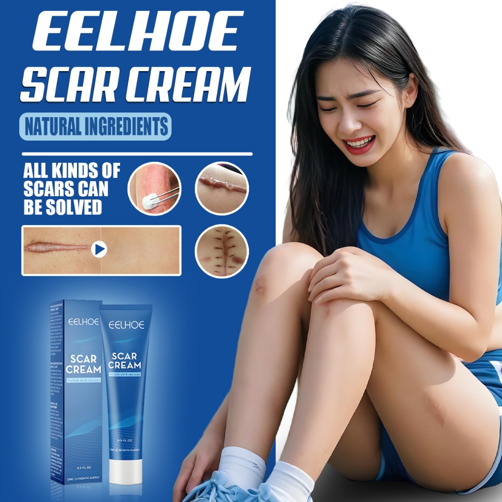 EELHOE salep bekas luka Ampuh dermatik salep penghilang bekas luka ori/obat penghilang bekas luka ko
