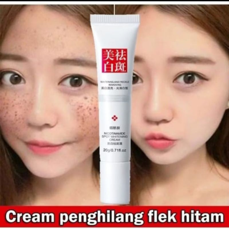 FUYAN Cream Penghilang Flek Hitam Nicotinamide Spot Whitening Cream 20g