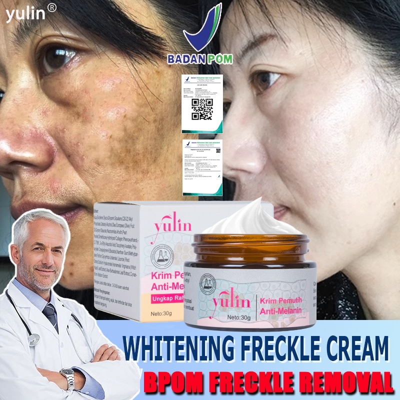 【BPOM】yulin Menghilangkan flek pada wajah Whitening Cream-cream penghilang flek hitam-salep flek hit