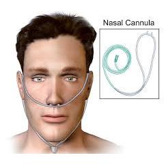 Masker Oksigen & Selang Kanula untuk Oxygen Concentrator O2-Life