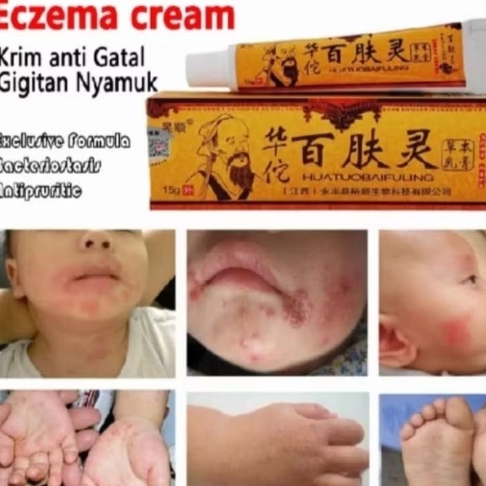 salep gatal salep cap orang tua salep cina salep anti gatal salep cair krim gatal