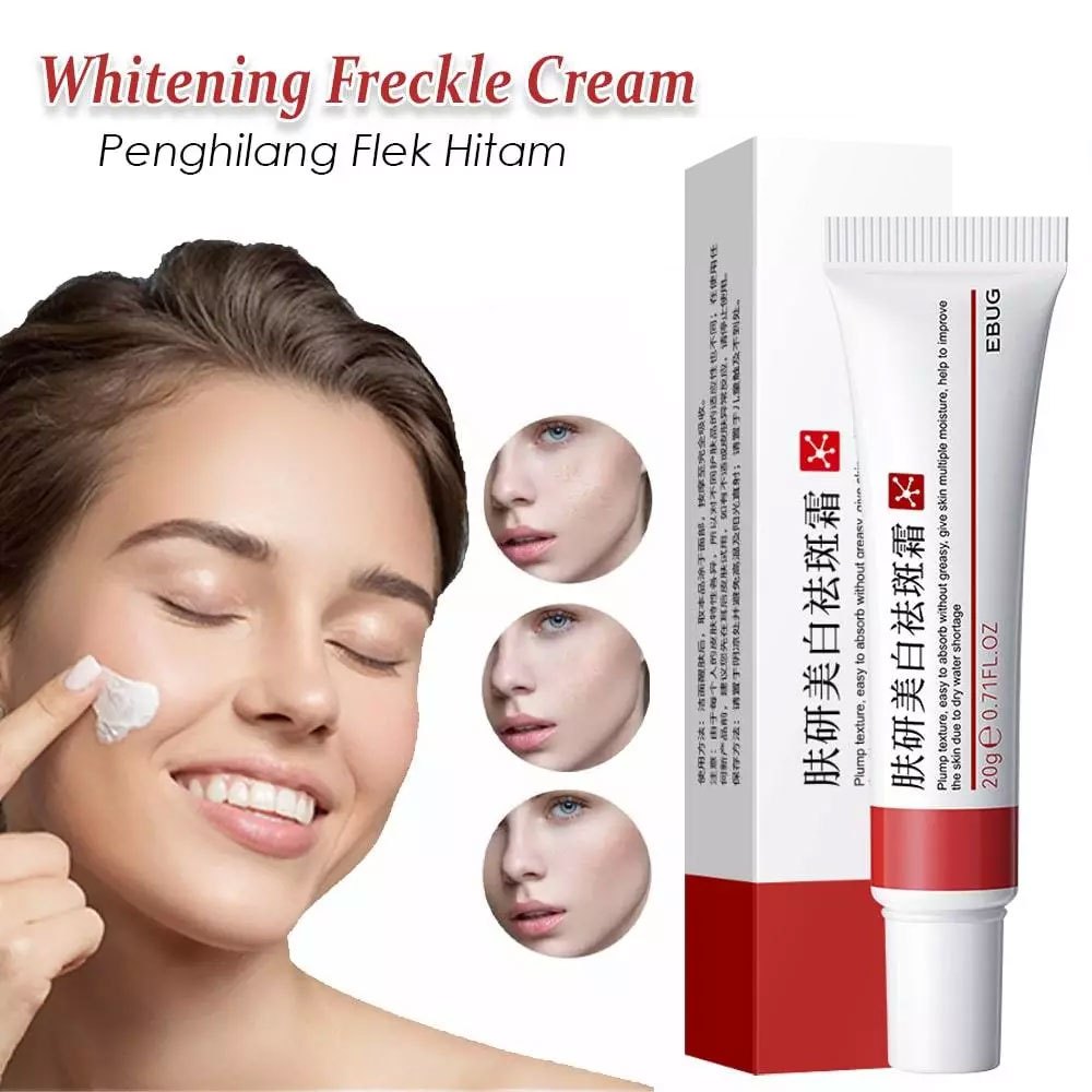 EBUG Whitening Freckle Cream Remove Dark Spot Penghilang Jerawat dan Flek Hitam Pemutih Wajah
