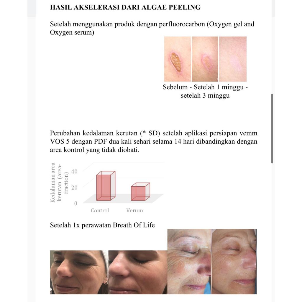 PEELING DECAAR-DEEP PHYTO COMPLEX-ALGAE PEELING