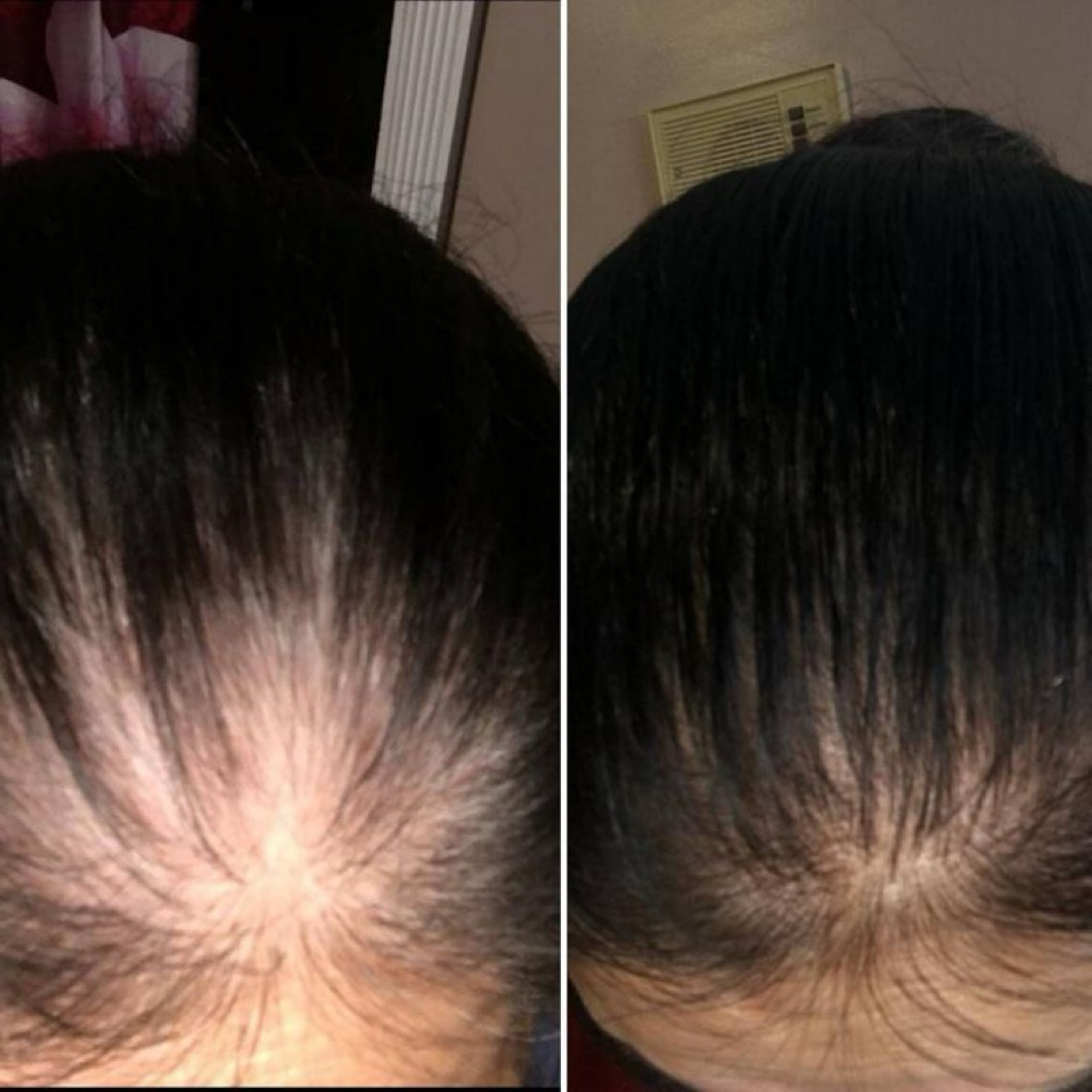 vitamin rambut rontok / serum rambut rontok / hair oil magic rontok