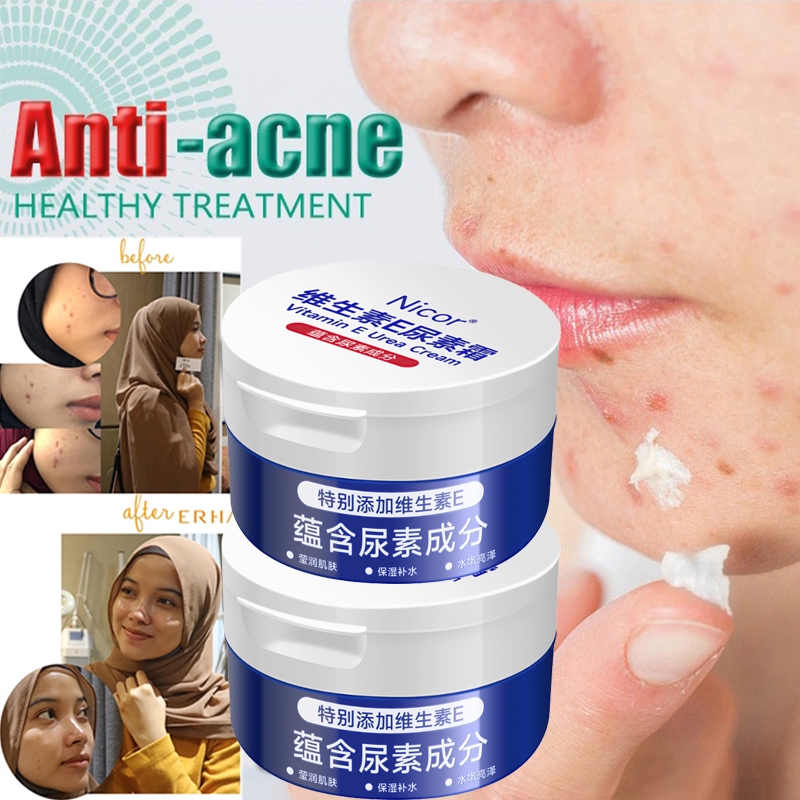 Cream Pengecil Pori Pori Wajah Ampuh Penghilang Flek Cream Moisturizing Whitening Mengecilkan Pori P