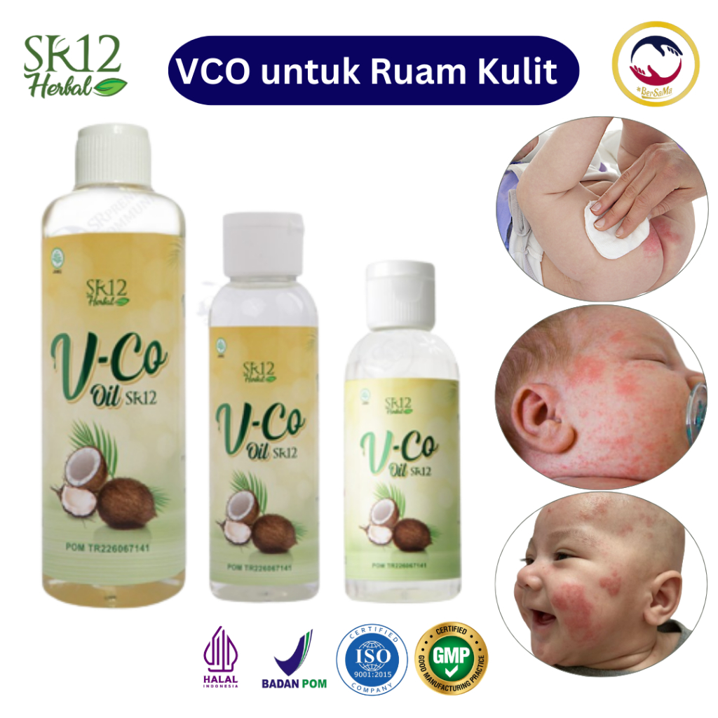 VCO SR12 Untuk Ruam Popok Minyak Bayi Biang Keringat Minyak Kelapa Untuk Bayi Gatal Kulit