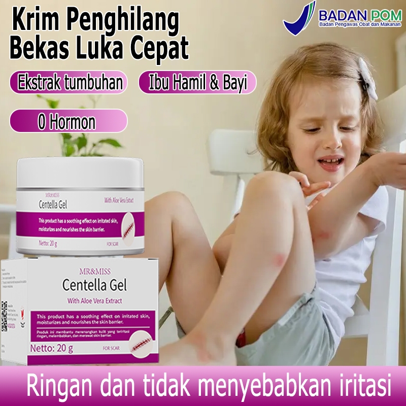 Cream penghilang bekas luka Salep penghilang bekas luka 20g Penghilang bekas luka anak Penghilang be