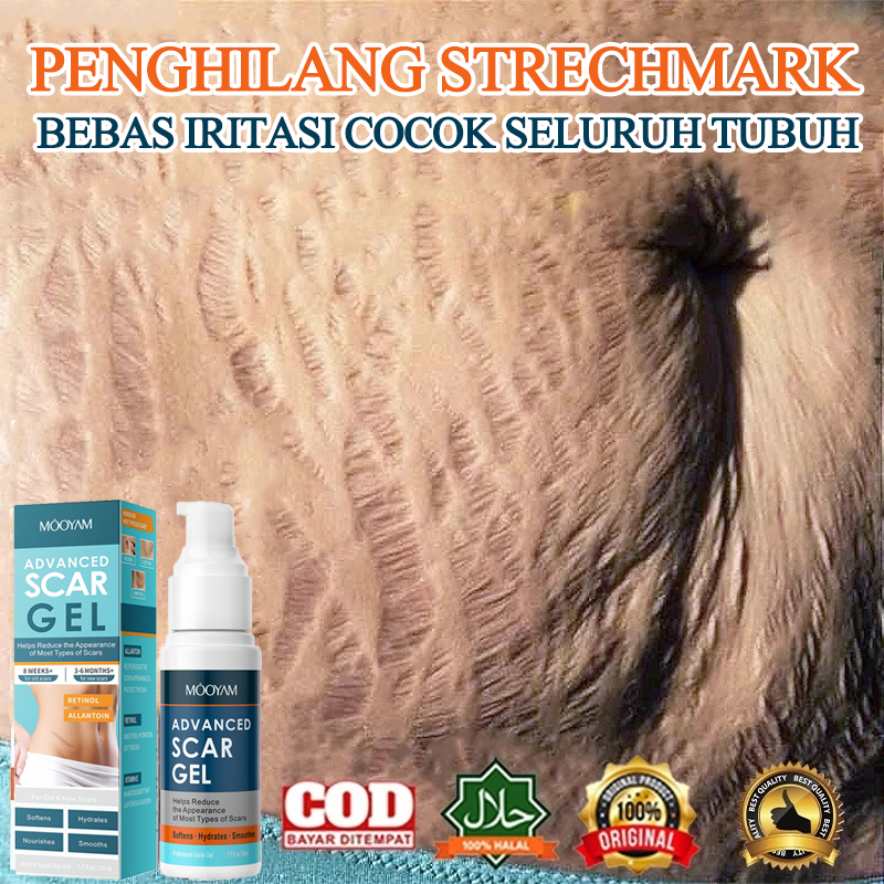 Krim stretch mark cream krim stretch mark ibu hamil Penghilang stretch mark efektif menghilang stret