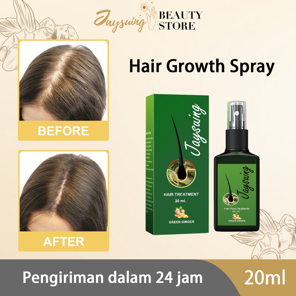EELHOE rambut Solusi pertumbuhan Penumbuh Rambut Botak Dan Rontok Hair Tonic Penumbuh Rambut Botak M