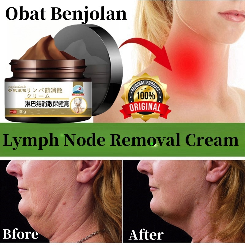 【COD ORI】Obat Benjolan Obat Salep Cream Krim Untuk Penghilang Benjolan Kelenjar Getah Bening Lipoma 