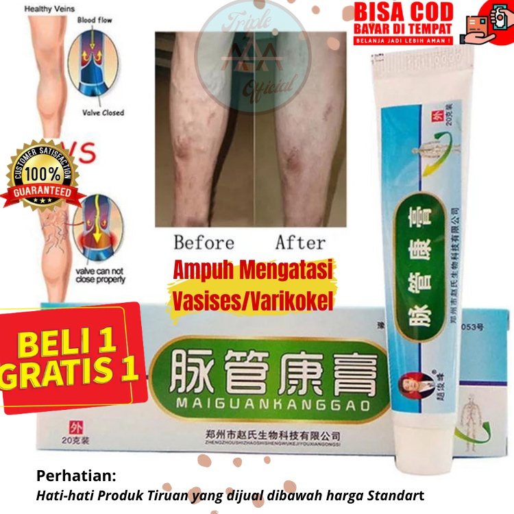 TRIPLE A - Salep Varises Obat China Cina Maiguankanggao Original Obat Varises Nodul Vaskulitis Varik