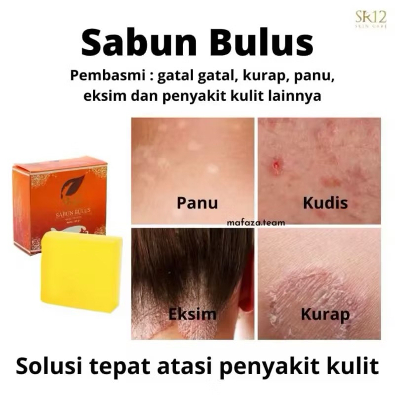 SABUN BULUS SR12 HERBAL BPOM ORIGINAL MENGHILANGKAN GATAL KULIT AMAN BUMIL BUSUI KURAP KUDIS -BULUS 