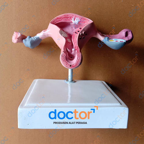 [doctor] Uterus Ovary Anatomical Model Anatomi-Manekin Model Uterus Rahim-Torso Uterus Ovarium