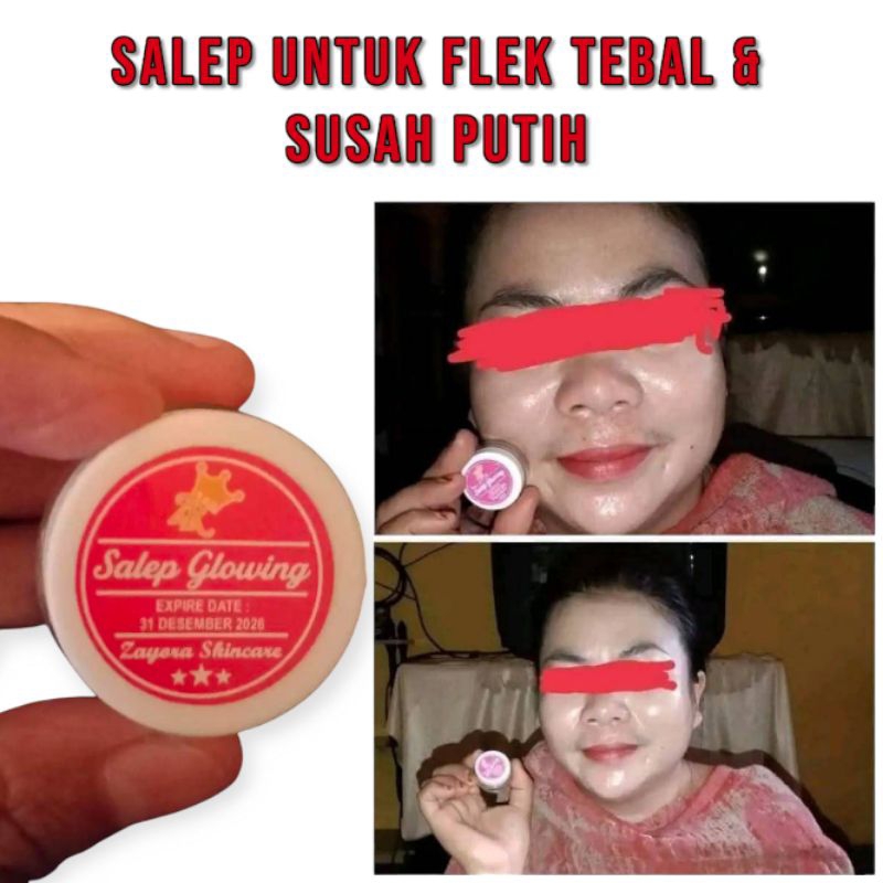 Salep pelicin glowing Zayora - Penghilang flek hitam tebal krim malam pencerah penghilang jerawat da