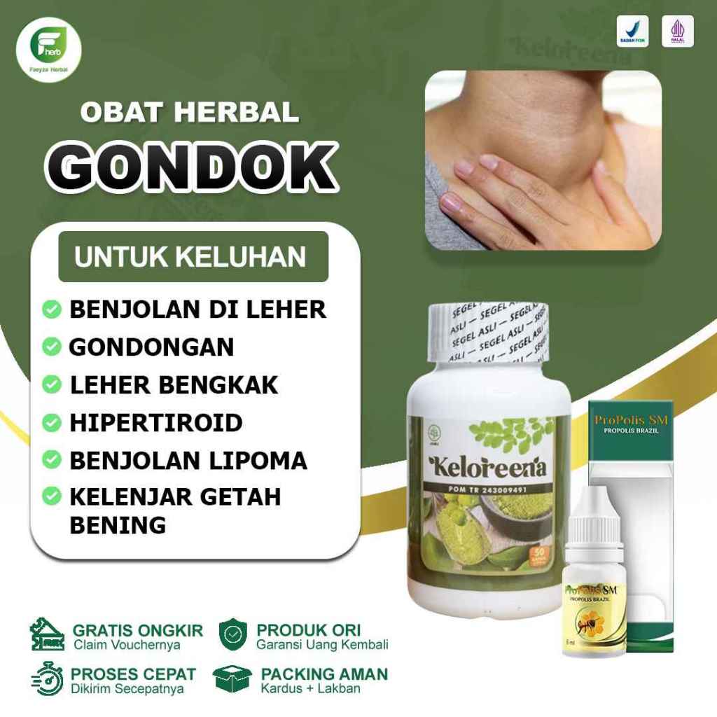 Obat Gondok Benjolan Di Leher Hipertiroid Gondongan Beracun Gondokan Kelenjar Tiroid Keloreena Kapsu