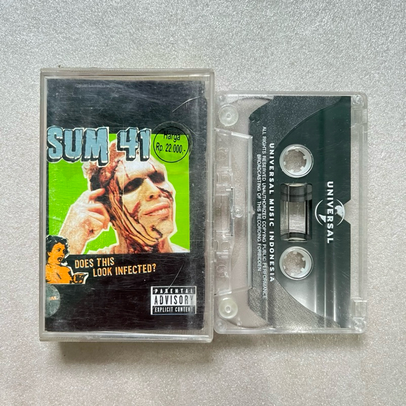 KASET SUM 41
