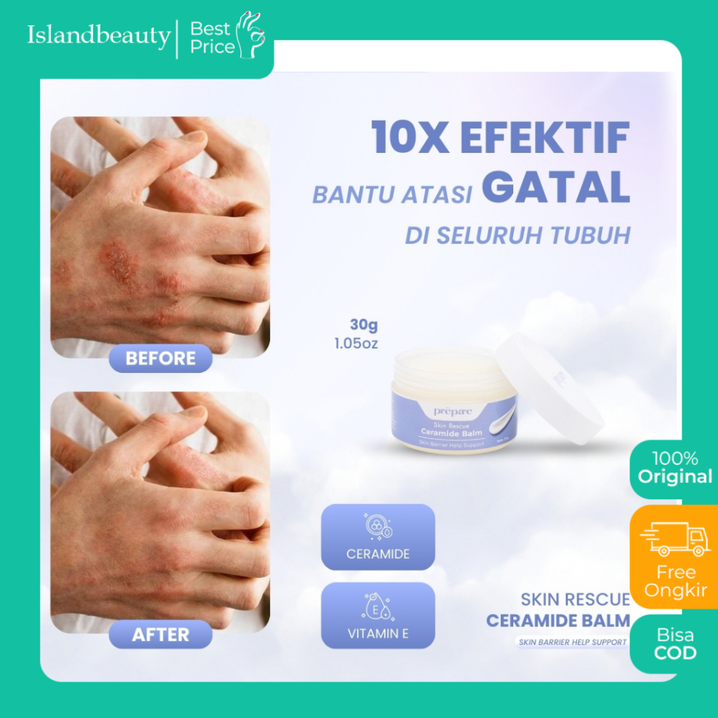 Prepare - Salep Eksim Pelembab Kulit Kering Tangan Kaki Obat Gatal Jerawat Punggung Dan Bekasnya
