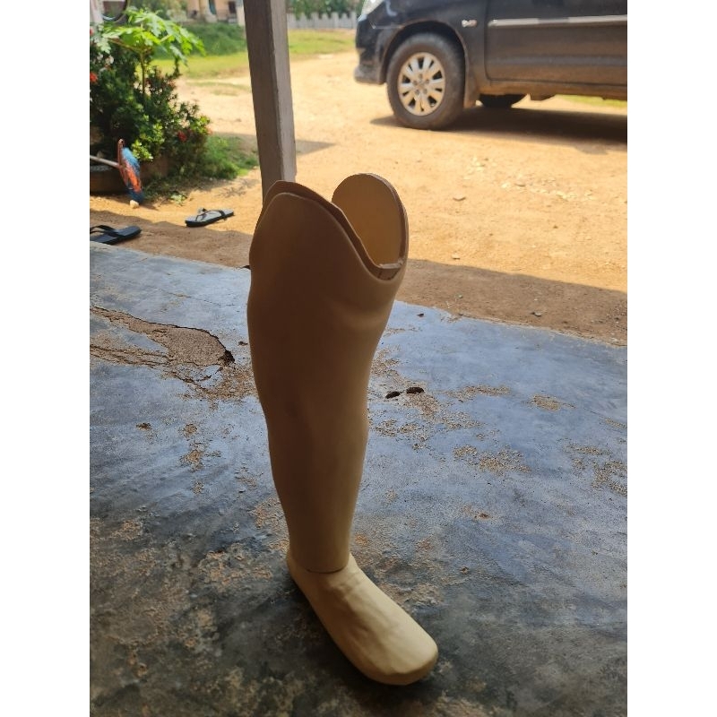 Kaki Palsu di Bawah Lutut