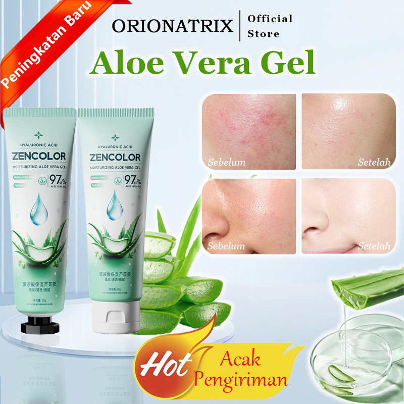 Orionatrix Lidah Buaya Aloe Vera Gel Moisturizer Lidah Buaya Gel Untuk Wajah Memudarkan Bekas Jerawa