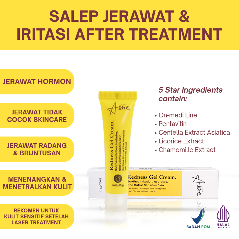 ASTRE REDNESS GEL CREAM Krim Salep Jerawat Kulit Sensitif Iritasi Menghidrasi Menenangkan Kulit
