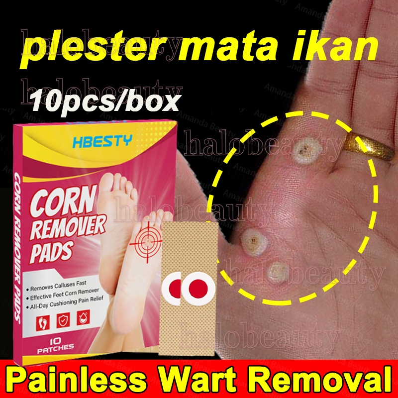 Plester Mata Ikan 10pcs Plester Obat Kutil & Mata Ikan Obat Kutil Dan Mata Ikan/Plester Obat Kutil/C