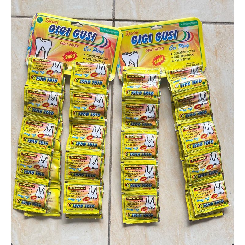 gigi band gusi ces pleng