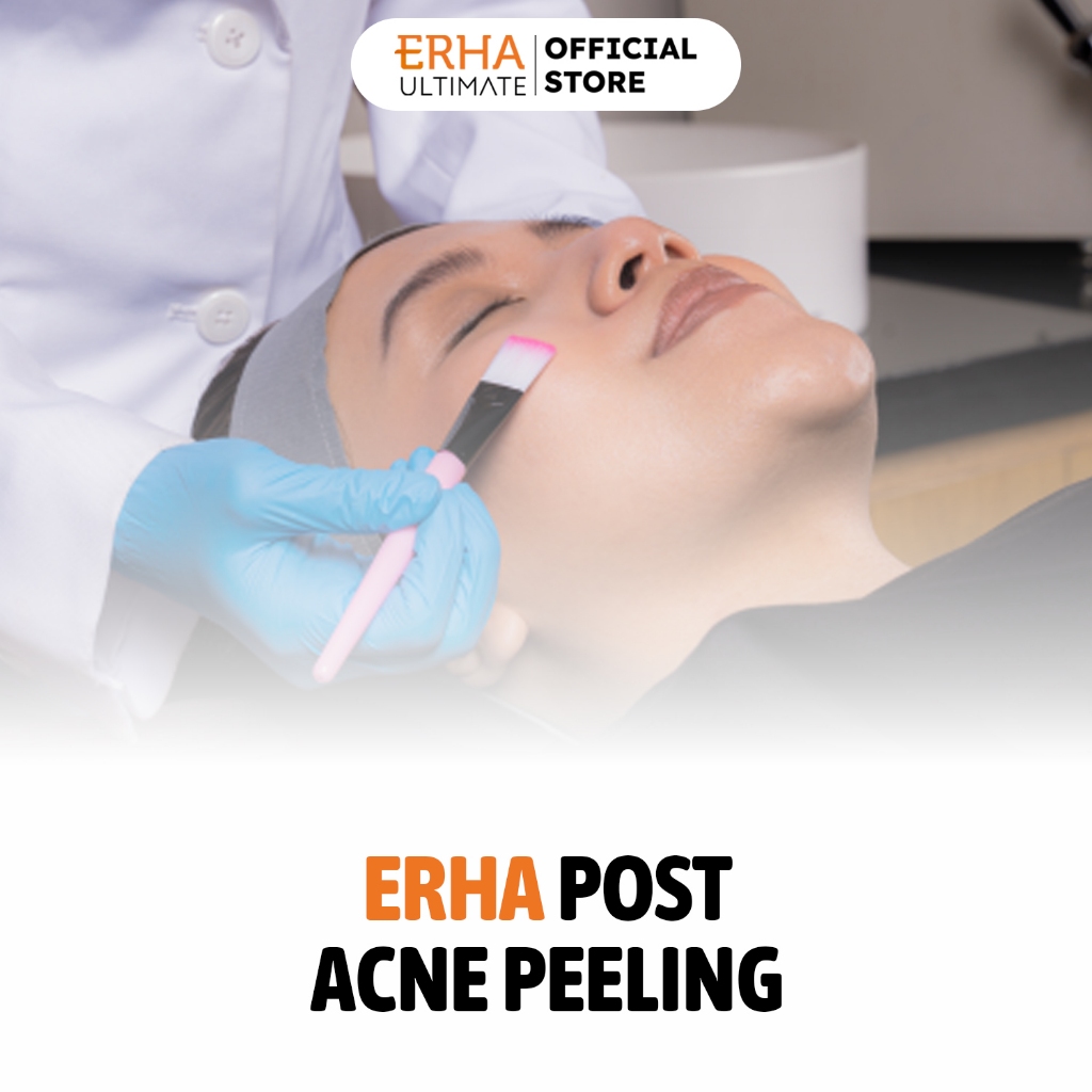 ERHA Post Acne Peeling - Perawatan Wajah Mengurangi Bekas Jerawat