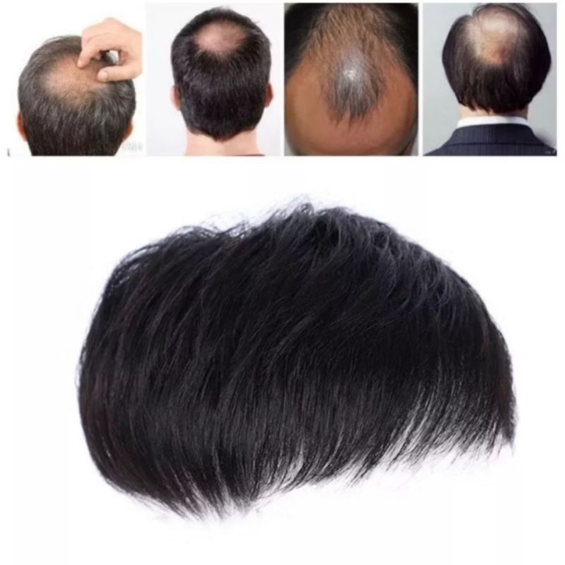 Rambut Palsu Penutup Botak/TOUPEE/Penutup Botak Pria