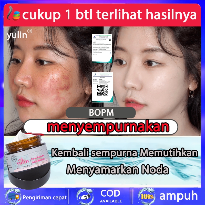 【BPOM】YULIN WHITENING CREAM PEMUTIH BPOM 30Gr WAJAH PENGHILANG FLEK HITAM CREAM WHITENING AND FRECKL