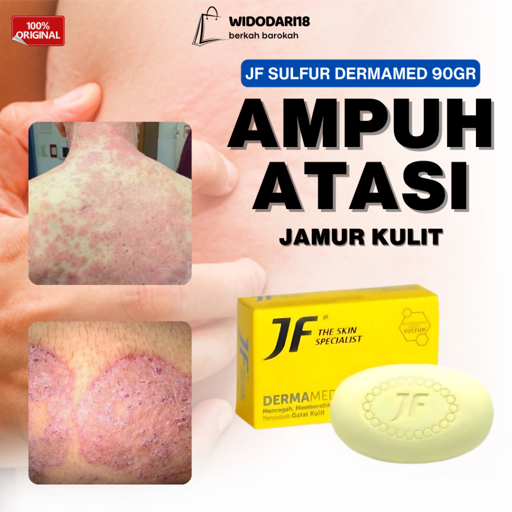 SABUN GATAL JF DERMAMED 90 GR / Sabun JF Sulfur untuk Gatal Jamur