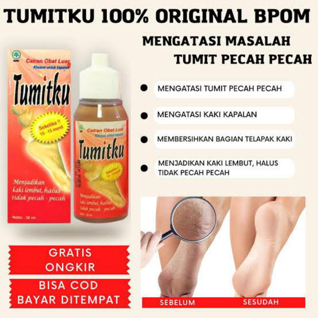 Tumitku Obat Herbal Kaki Pecah-pecah/Penghalus Tumit Kaki