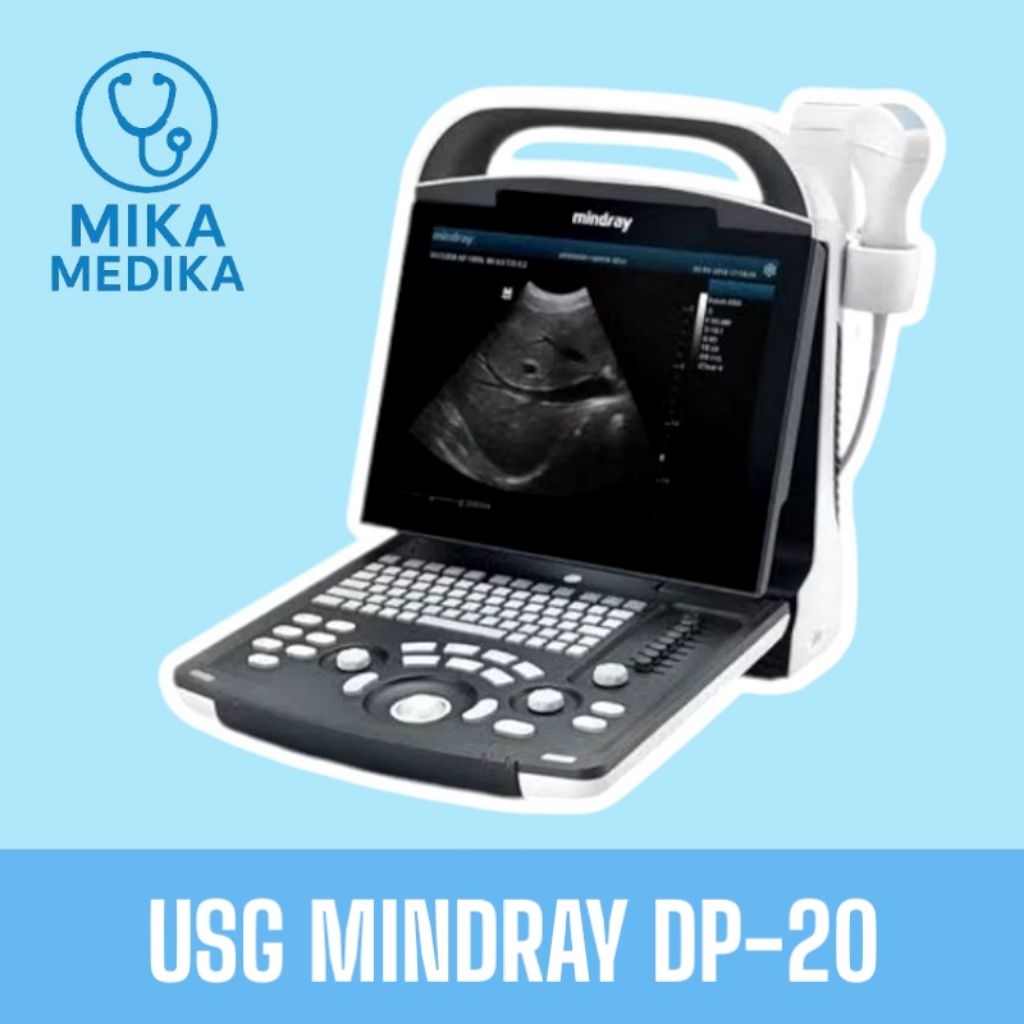 USG 2D Mindray Dp 20 / Usg 2 Dimensi Mindray DP-20