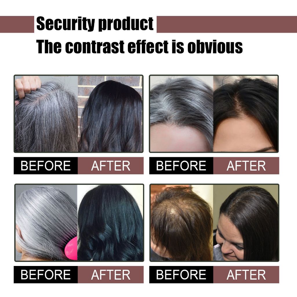 

Eelhoe Pria Rambut Hitam Sabun Penggelap Rambut Sabun Sampo Bar Penggelap Polygonum Essence Hair